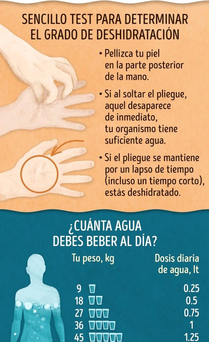 Cómo Saber Si Padeces Deshidratación De Forma Sencilla Infografías Y