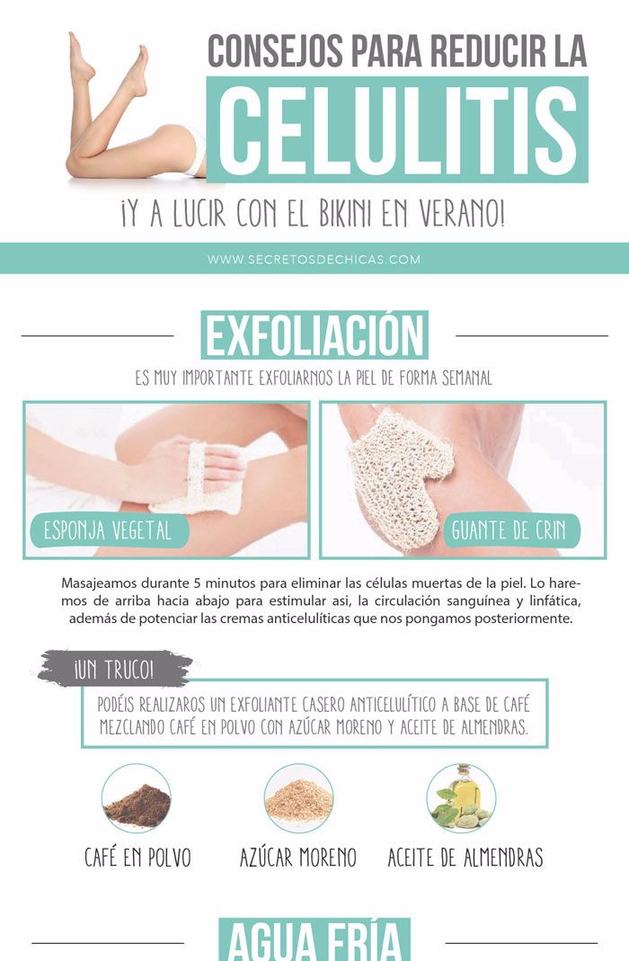 Consejos Para Reducir La Celulitis En Las Piernas Infografías Y Remedios 5039